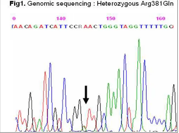 Fig. 11 - Risultato del sequenziamento genico del gene IL23r. Il campione  risulta eterozigote per la variante allelica Arg381Gln, (G          A) 