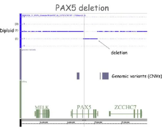 Fig.  1.3  Schematic  representation  of  PAX5  deletion  in  a  patient  with  Ph+  ALL  as  detected  by  SNP  array  analysis