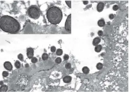 Figura 4.: Escherichia coli adesi a mucosa intestinale che hanno causato lesioni dei villi;  trat- trat-to da Foster 2008 ( 28) 