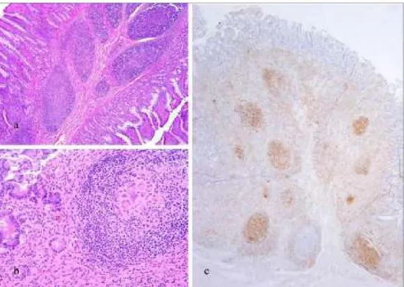 Figura 2.5.  Suino, ileo a: aspetto istologico normale. Presenza di voluminosi follicoli linfatici, E&amp;E, 5x; b: 