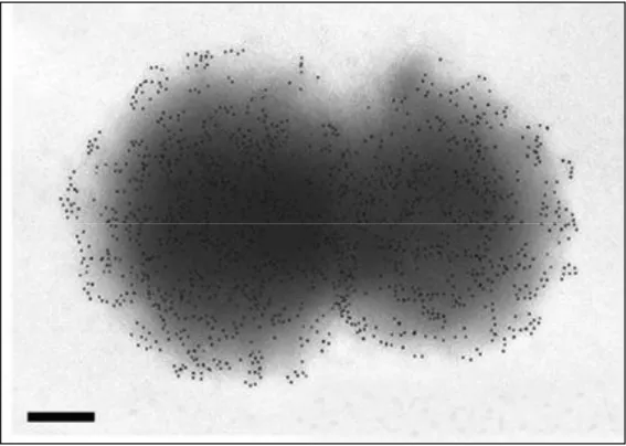 Figure  1:  ImmunoGold  labelling  and  transmission  electron  microscopy  of  N. 