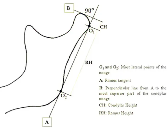 Fig.  5  tracciato  eseguito  sulle  panoramiche  secondo  Habets  et  al  (54).  