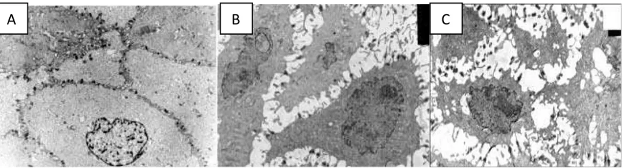 Fig  1.1:  Mucosa  esofagea  osservata  tramite miscroscopia  elettronica :  gli  spazi  intercellulari  risultano  maggiormente dilatati nei pazienti con malattia da reflusso non erosiva (B) ed erosiva (C) rispetto ai controlli (A) 