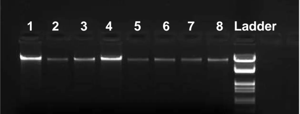 Figura 7.1 Analisi elettroforetica di 8 campioni di DNA estratti da alcune popolazioni
