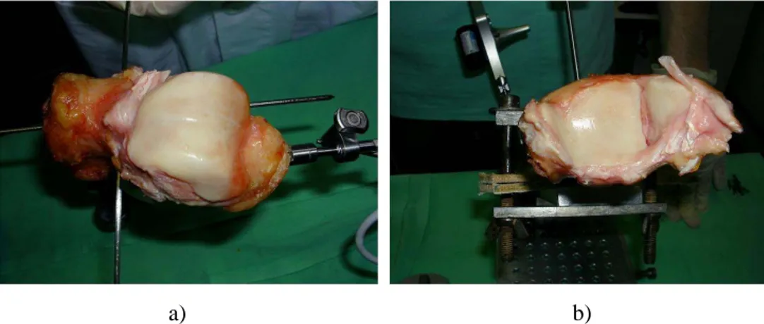 Figure 3.4: The tibio-talar articular surfaces for a) the talus and b) the tibia.