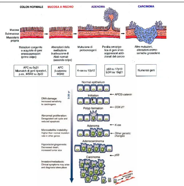 Figura 2. Modello genetico della tumorigenesi del carcinoma colon-rettale che  mostra l’accumularsi delle mutazioni negli oncogeni e negli onco-soppressori che  contribuisce alla progressione tumorale e allo sviluppo delle metastasi