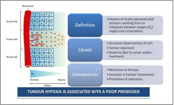 Figura 6 Meccanismi attraverso i quali l’ipossia cronica favorisce una prognosi  peggiore per i pazienti malati di tumore 