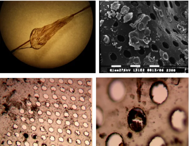 Figura  2:  Immagine  macroscopica  di  un  filtro  di  protezione  distale  (in  alto  a  sinistra),  microscopia  a  scansione  (in  alto  a destra),  microscopia  ottica  (2.5x  in  basso a sinistra, 10x in basso a destra)  