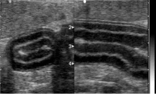 Fig.  2.5.  Immagine  ecografica  bidimensionale  in  sezione  longitudinale  e  trasversa  di  un’ansa  intestinale di un gatto