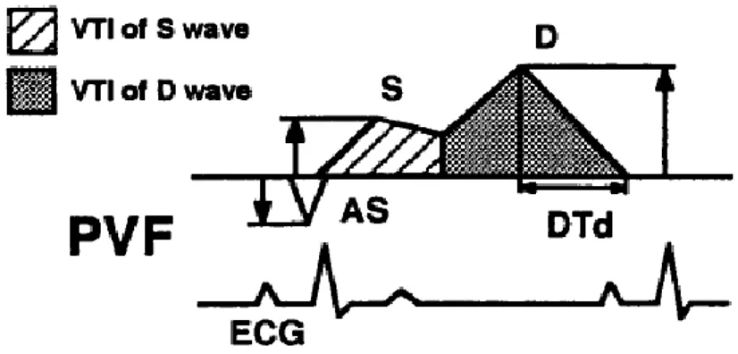 Figura 10: Rappresentazione schematica del  profilo flussimetrico venoso polmonare normale  nel cane