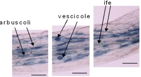 Figura 1. Strutture intraradicali caratteristiche dei funghi micorrizici arbuscolari, radice di  pomodoro al microscopio ottico (ingrandimento 10 x) scala (barra nera) 0.1 mm 