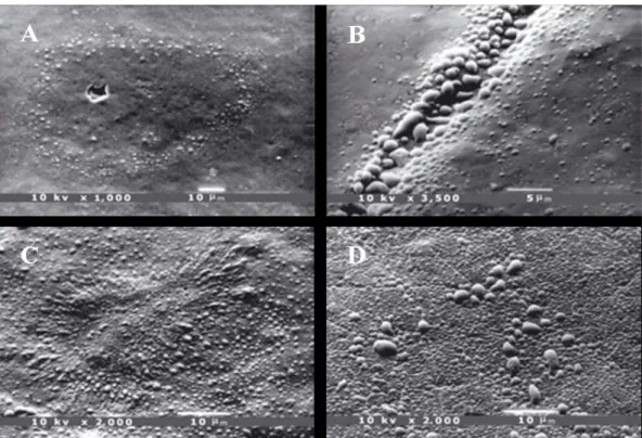 Fig. 4   Details of an enamel pore (A) and an enamel crack (B), and samples of white spot lesions (C,D)