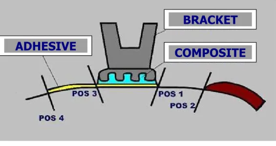 Fig. 1   Analyzed positions for the evaluation of demineralization area: 