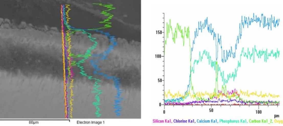 Fig. 8  EDX  mapping  of  the  enamel  demineralization  in  a  sample  of  group  B  showed  a  homogeneous  distribution of calcium and phosphorus within the lesion