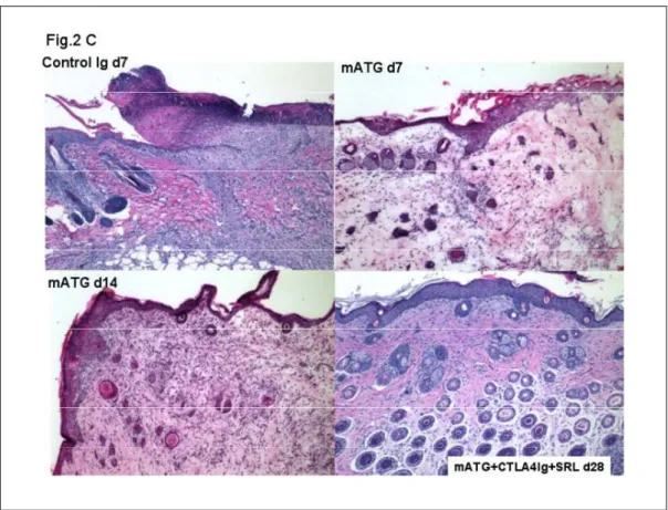 Figure 2C. H and E stained light micrographs depicting features of acute  rejection in grafts harvested 7 days after transplantation from recipients  treated with control Ig (left upper panel); minimal infiltration of grafts  harvested 7 days after transpl