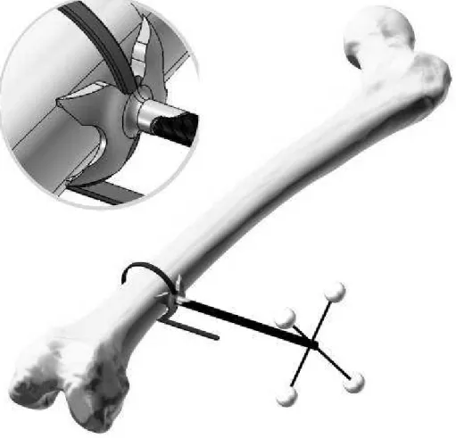 Figure 1 Model of the femur with the marker and close-up of the fastening strap 