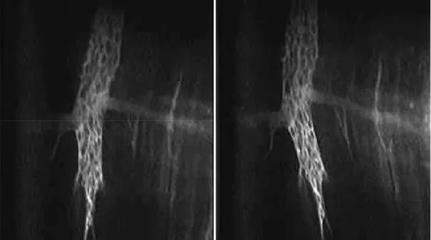 Fig.  5.  Different  frames  from  a  freely  moving  ganglion  movie.  It  is  noteworthy  that  the  lower  part  of  the  ganglion  during  the  physiological  contraction  twists  on  the  right  direction  provoking  a  deformation in individual neuro