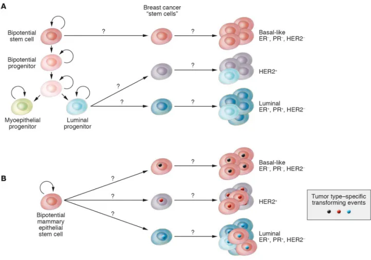 Figure 2: Breast cancer stem cells may originate from normal stem/progenitor stem cell (A) or bipotential stem cell (B)  and can give raise to breast cancers over-expressing peculiar lineage markers (i.e