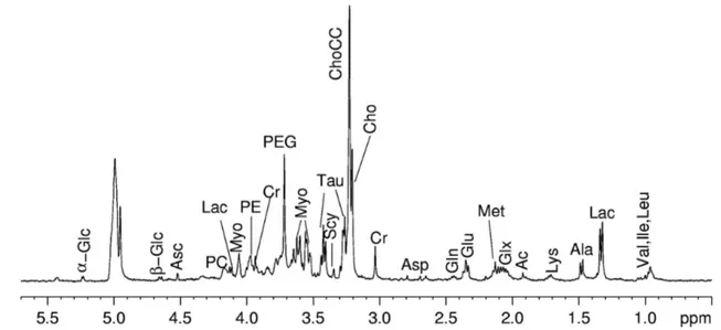 Figure  12. 1D proton NMR spectra of healthy gastric  mucosa obtained  with  CPMG sequence  with total  spin- spin-echo time 2nτ=360 ms