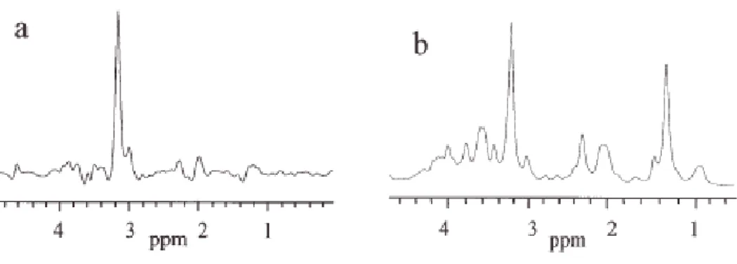 Figure 6. Comparison of the in vivo  1 H spectrum, recorded at 1.5 T, of the medulloblastoma (a) and its ex vivo 