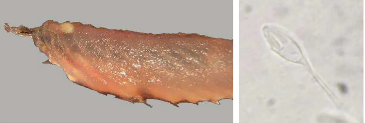 Fig. 7 – Cisti muscolare contenente spore di Henneguya spp. in pesce persico. 