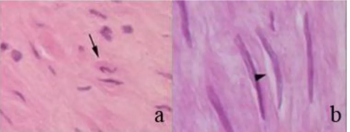 Fig.  20:  Light  Microscopy  20X:  Human  Thoracic  Aortas  after  cryopreservation:  LM  shows  a  normally  looking  media  with  nuclear  polymorphism  and  hypercromasia  (              ,  a)  and    with  focal  perinuclear  clearings  close to SMCs 