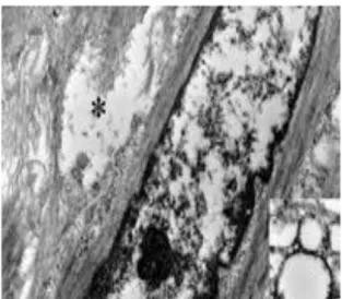 Fig  21:  Transmission  Electron  Microscopy.  Fresh  Human  Thoracic  Aortas  from  multiorgan  donor