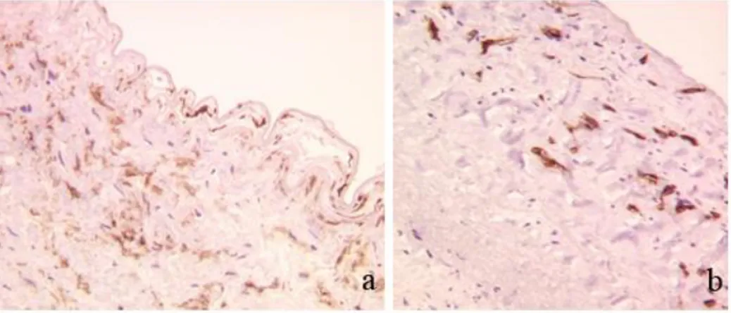 Fig.  23:  Human  Thoracic  Aortas:  CD34  staining;  a)  unfrozen  arterial  sample; b) Cryopreserved arterial sample 