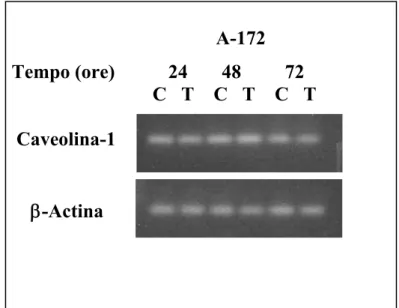 Figura 9. Valutazione dell’espressione dell’mRNA di Caveolina-1 tramite RT- RT-PCR nelle linee cellulari di glioblastoma umano CRS-A2 e A-172 in assenza (C)  o presenza di 4-HPR 10 μM (T)