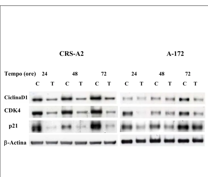 Figura 10. Analisi in Western Blotting dell’espressione di CiclinaD1/CDK4 e  p21 nelle linee cellulari di glioblastoma umano CRS-A2 e A-172 in assenza (C)  o presenza di 4-HPR 10 μM (T)