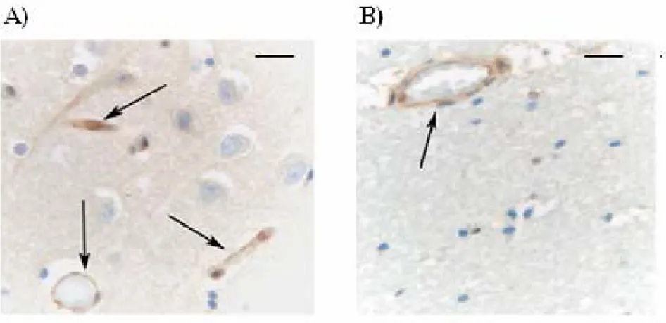 Figura 9. L’immunoproteasoma è espresso nelle cellule endoteliali del SNC di  soggetti giovani non affetti da demenza