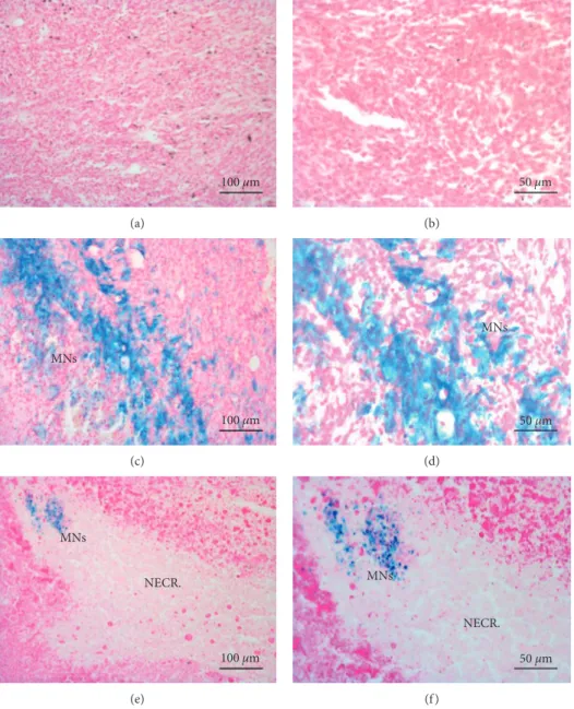 Figure 6: Histological analysis of tumors. (a, b) Histological sections of tumors treated with saline