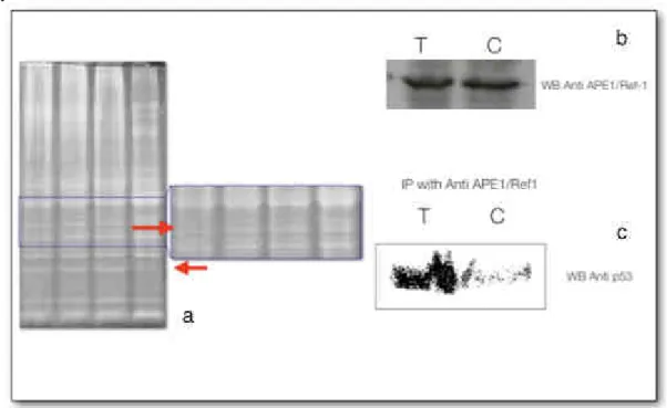 Figure 3. a) red arrows indicate differentially present protein bands in whole liver lysates, which are undergoing mass  spectrometry identification; b and c) show that while the expression of APE1/Ref1 remains unchanged in the liver after the  administrat