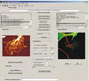 Fig. 3. Snapshot of the graphical user interface (From Kondra et al., 2009, Journal of  Neuroscience Methods, ELSEVIER)