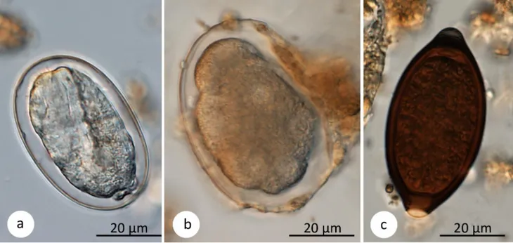 Fig 2. Parasite eggs. Sample pictures of gastrointestinal parasites found by sedimentation and flotation methods in Udzungwa red colobus monkeys: (a) Strongyloides fulleborni, (b) strongylid nematode, (c) Trichuris sp