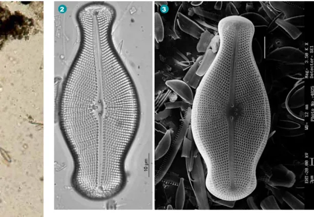 figure 1-3: Didymoshenia geminata osservata al  microscopio ottico (1-2) e elettronico (3)