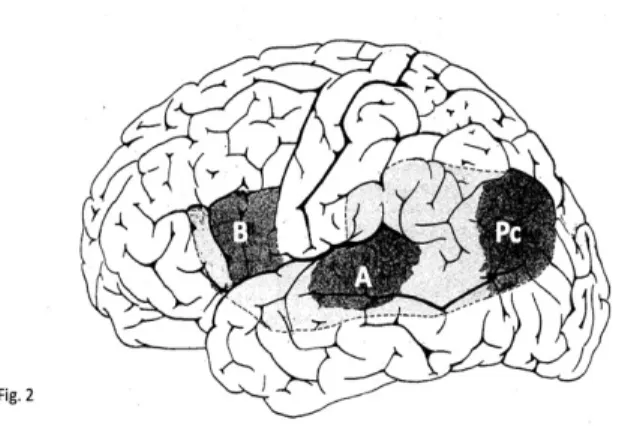 Fig. 2 – Il modello anatomo-clinico del linguaggio di Déjerine (1914). B: circonvolu- zione di Broca (centro delle immagini motorie dell’articolazione)