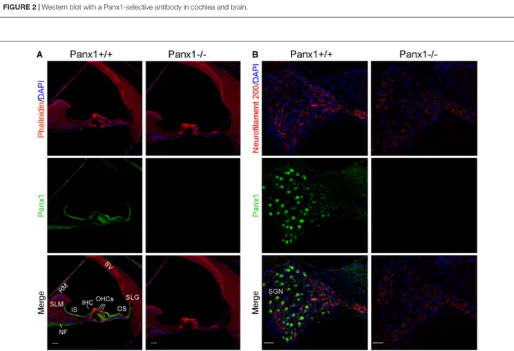 FIGURE 3 | Immunofluorescence with a validated Panx1-selective antibody in cochlear midmodiolar sections