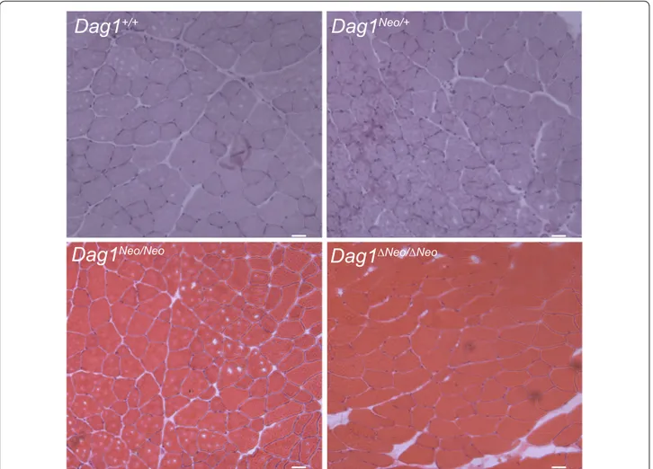Fig. 2  Histological analysis of skeletal muscle. Hematoxylin and eosin staining of transverse frozen sections of tibialis anterior muscle of 5 months  old Dag1 +/+ , Dag1 Neo/+ , Dag1 Neo/Neo , and Dag1 ΔNeo/ΔNeo  female mice (4 mice per group)