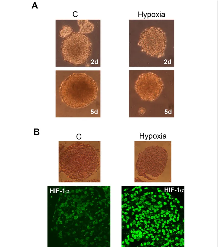Figure 6 Hypoxia influences growth and HIF-1 a activation in cancer stem cells from GBM