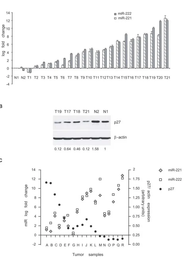 Figure 4. MiR-221 is strongly expressed in prostate carcinoma-derived primary cells and its expression inversely correlates with that of p27