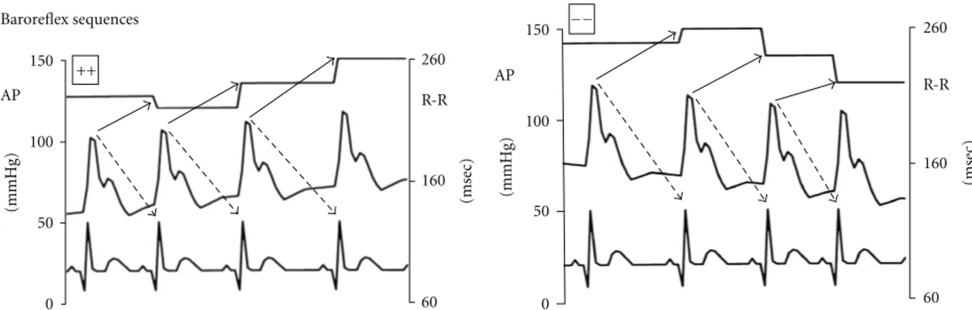 Figure 2: Examples of the arterial pressure, ECG signals and of the corresponding pulse intervals