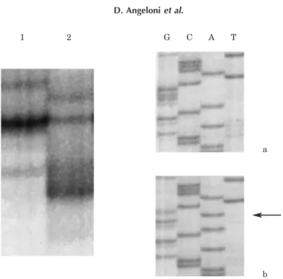 Fig. 1. SSCP analysis of the Alpha 2 Delta 2 calcium channel gene in lung cancer patients, by means of MJE7 primers, revealed the presence of an intronic SNP
