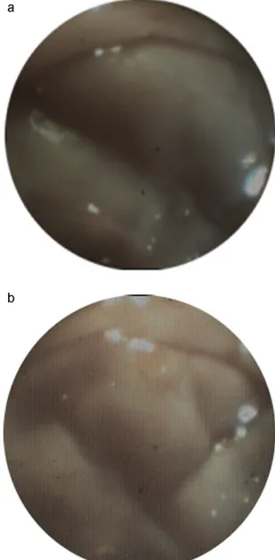 Fig. 3. Acquired images from different gastrointestinal tracts, during ex vivo tests.