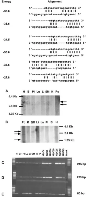 Figure 9. Expression studies of ESTs W91914 and H51703, chosen as representative of two EST clusters located in the region affected by the GCL20-3p12 homozygous deletion