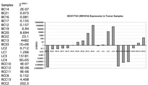 Figure 10. qRT-PCR Expression analysis of BC017743 (W91914) in  can-cer biopsies and normal related tissues.