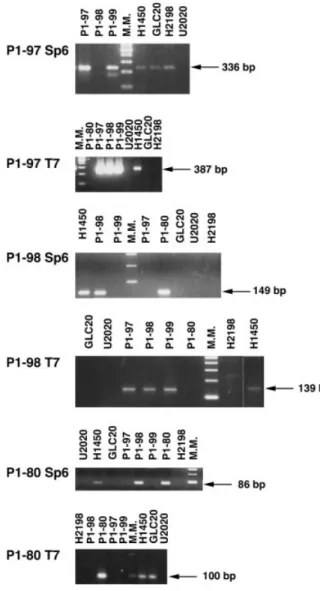 Figure 4. PCR experiments with primers located within the ESTs deleted in the GLC20-3p12 homozygous deletion and represented in the P1 contig
