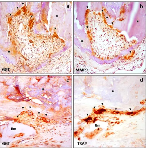 Fig. 2. GGT expression in stenotic aortic valve (II): relationships of GGT with areas of calciﬁcation