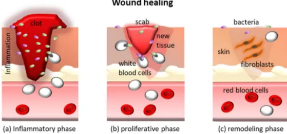 Figure 8. Schematic of the three phases of the wound healing process.