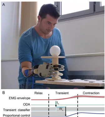 Fig.  4  Experimental  setup  of  the  online  system.  A)  Individual  with  below  elbow  amputation  wearing  the  research  prosthesis